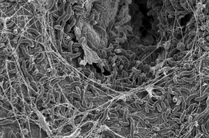 Vibrio cholerae bacteria, photo taken with a Scanning Electron Microscope.