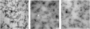 Transmission electron microscope image showing human cells to which engineered eCIS (red arrows) bind using their tail fibers prior to protein injection.