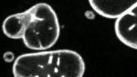 Micronuclei and Cancer