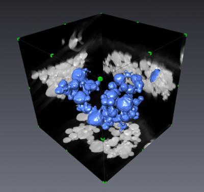Aluminum Nanoparticles
