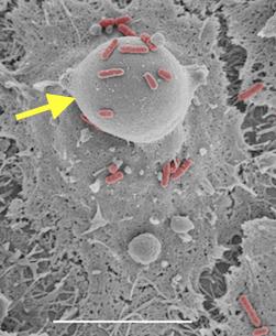 Electron Micrograph