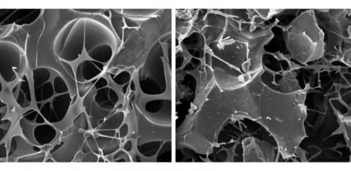 Graphene ‘scaffold’ recruits bone cells and helps the body regenerate fractures