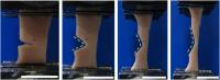 Tear Response of Collagen Fibrils in the Skin (2 of 2)