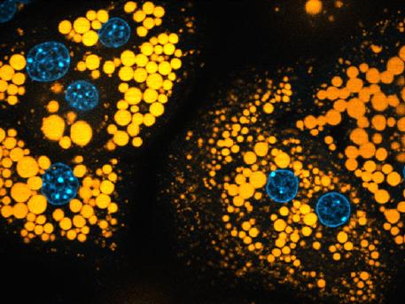 Picture of Liver Cells
