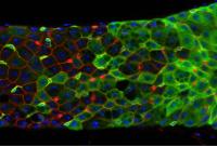 Fruit Fly Intestinal Tissue, (2 of 2)