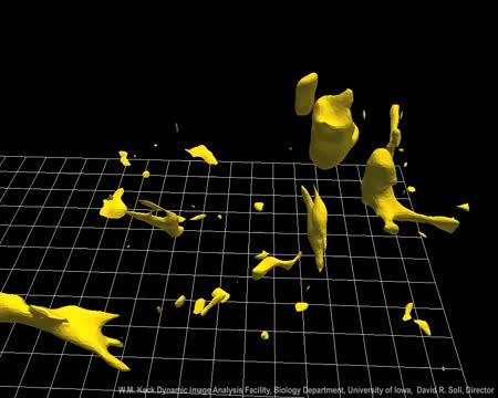 Melanoma Cells in Action