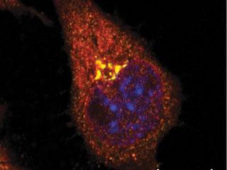 In the Golgi