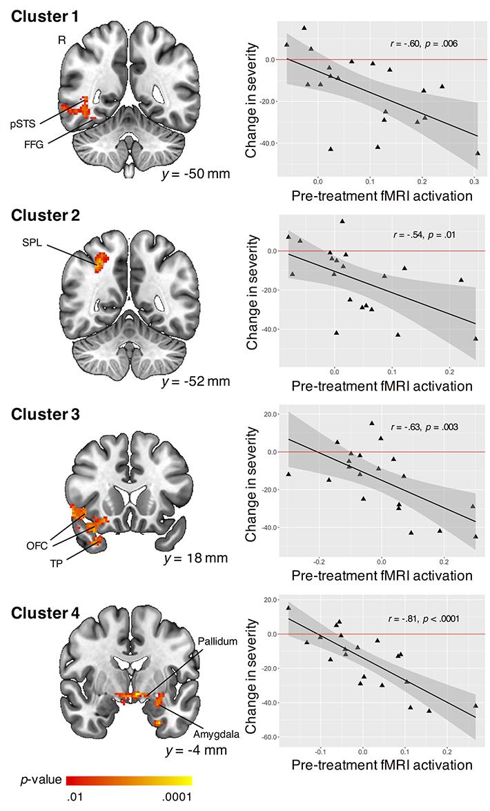 Brain Response Predicts Treatment Outcome in Young Children with ASD