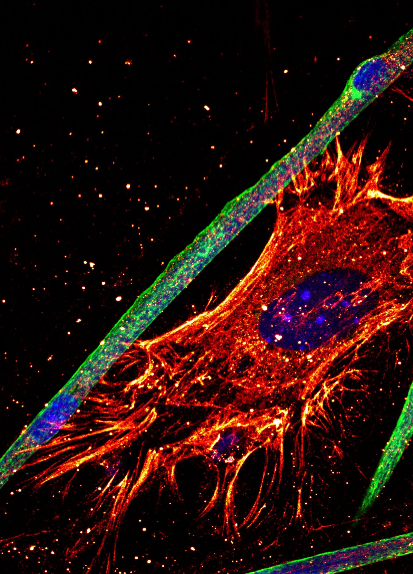 Muscle and Myofibroblast