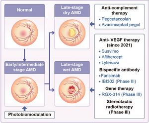 Classification and Treatment of Age-Related Macular Degeneration (AMD)