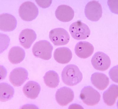 Vaccine Research Shows Vigilance Needed against Evolution of More-Virulent Malaria