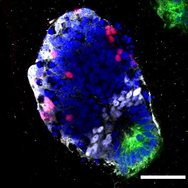 Piece of Spinal Cord in 3-D Culture