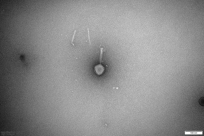 Microscope image showing new phage family in the KlebPhaCol collection