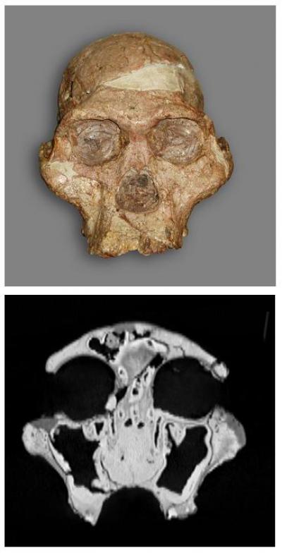 Photograph and CT Scan of Sts 5
