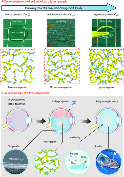 Chain entanglement-stabilized injectable zwitterionic polymer hydrogel for vitreous replacement and retinal tamponade