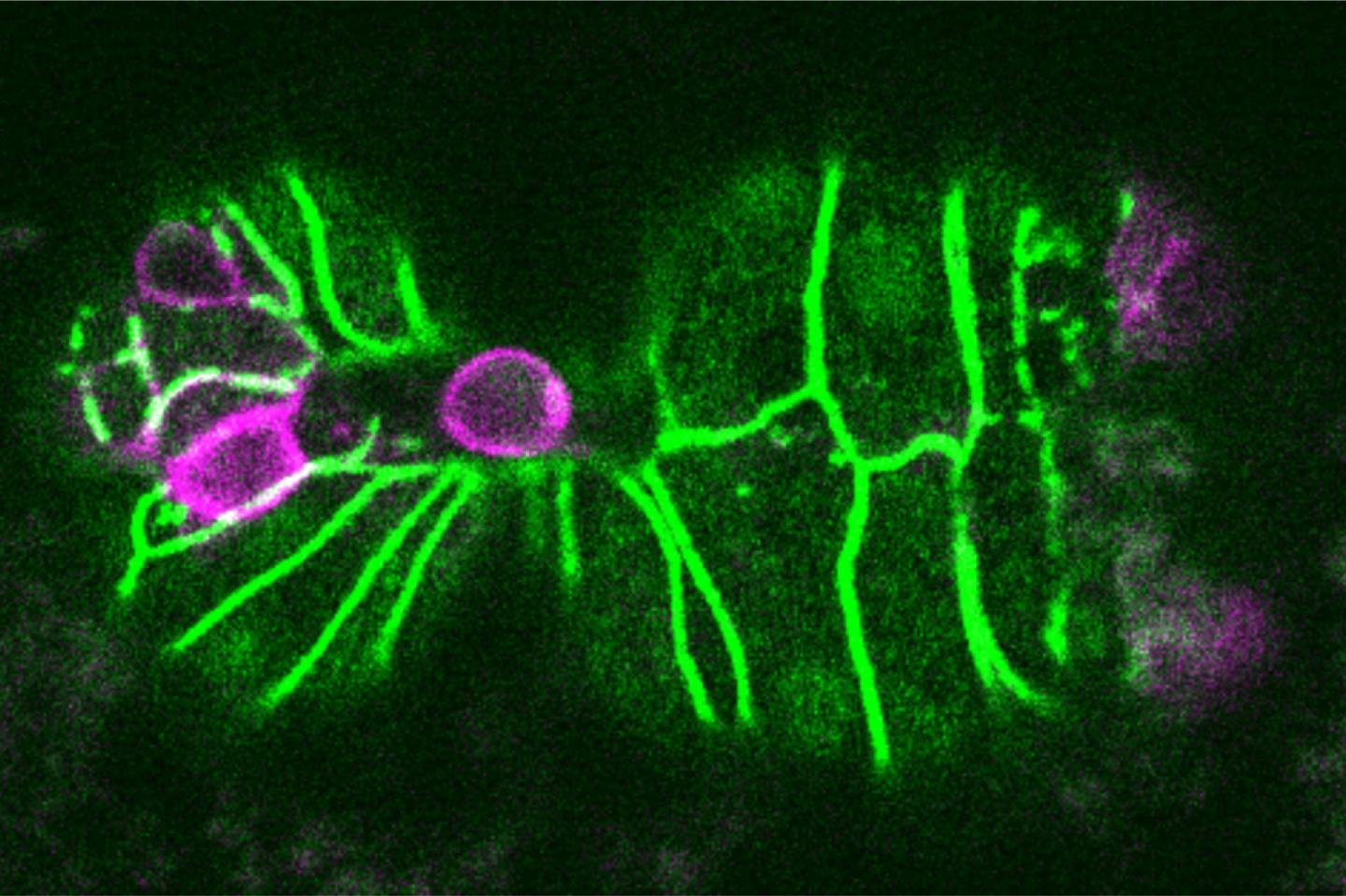 Cell Elimination