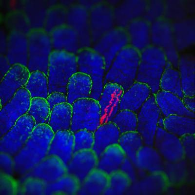 Cells with Mutations Don't Always Win (3 of 4)