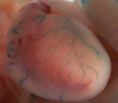 Olfr78 in Blood Vessels of the Heart