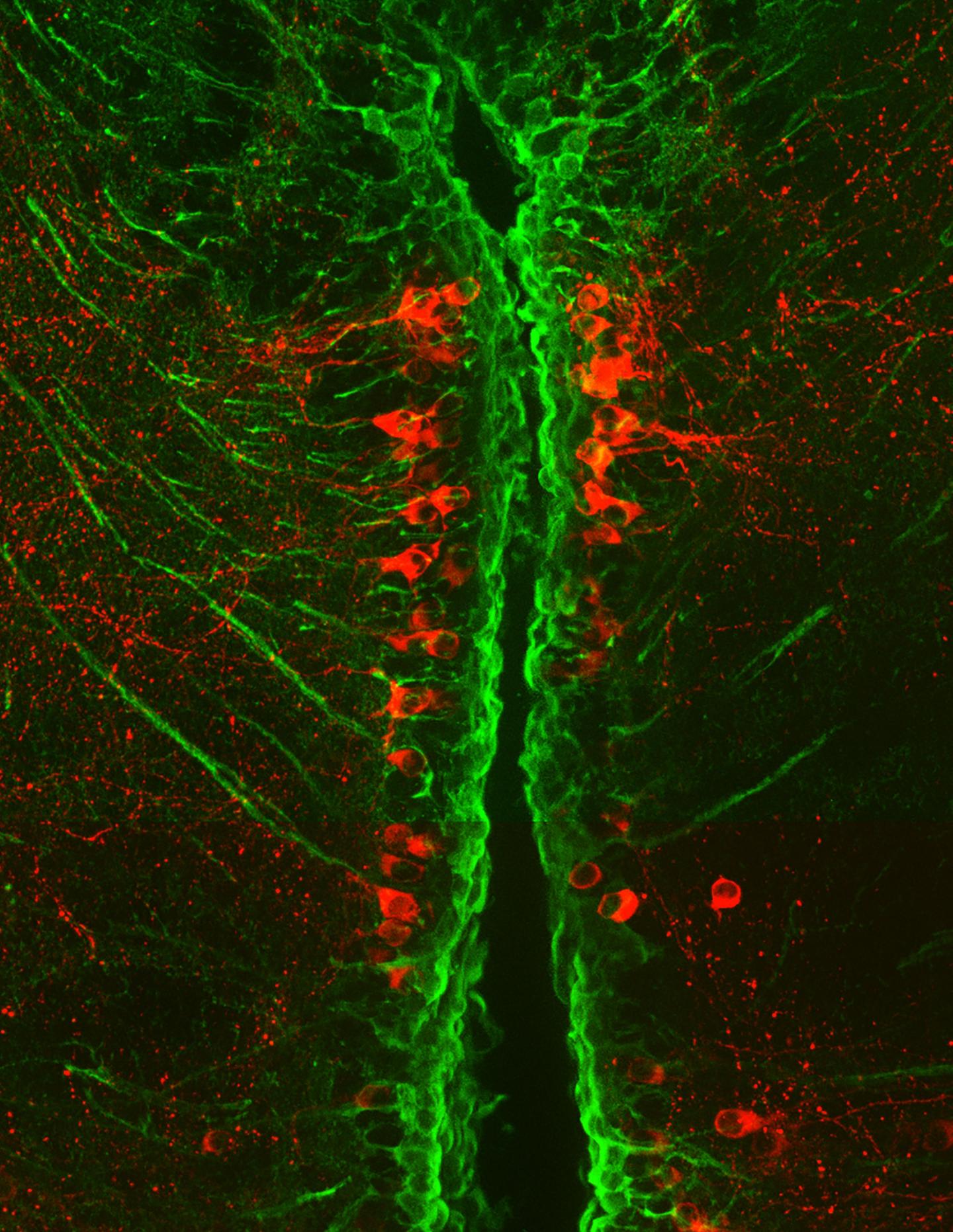 Parkinson's Clues Seen in Tiny Fish Could Aid Quest for Treatments