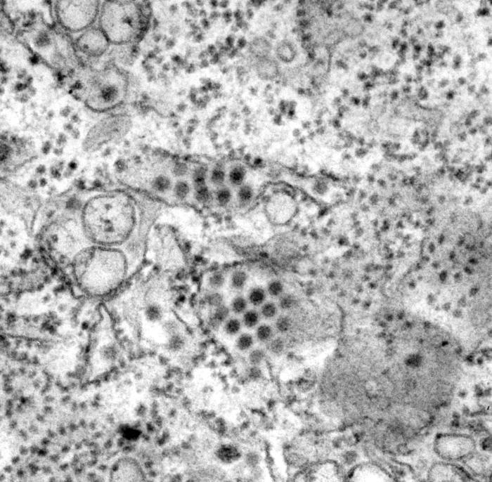 Dengue Virus Particles