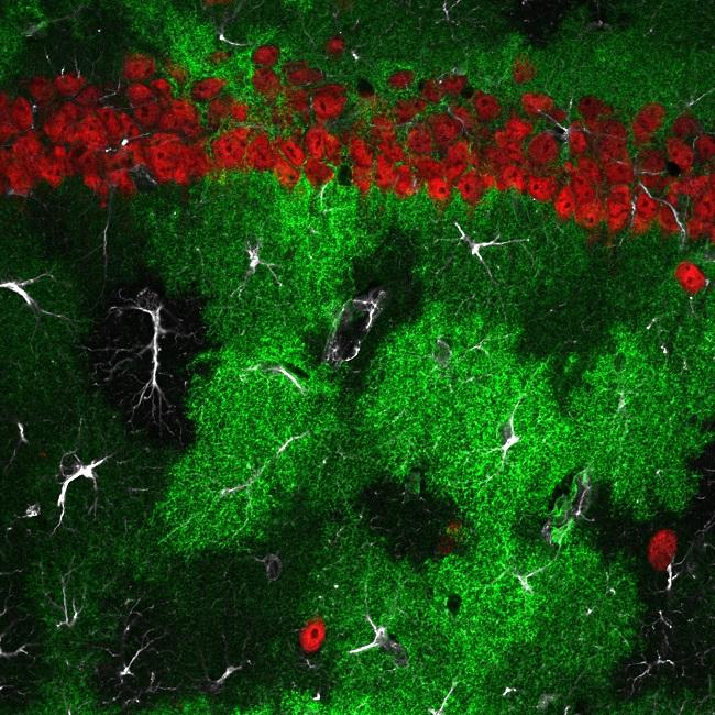 Astrocytes