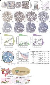 AC004854.2 as a prognostic biomarker in colorectal cancer (CRC) clinical settings.