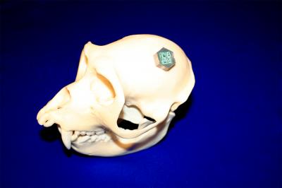Implant