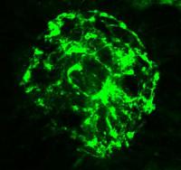 Proteins Critical to Wound Healing Identified