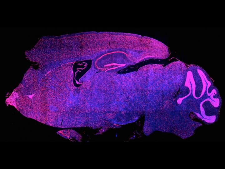 Brd4 Distribution in Mouse Brain