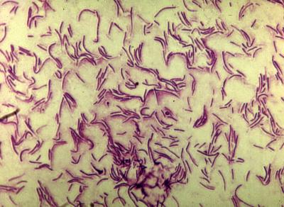 How Beetles Keep Bacteria in Check (12 of 15)