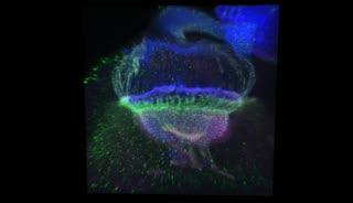 Optic Lobe of a Fly Larva's Brain