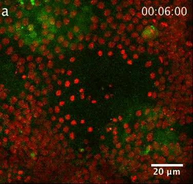 Fat Body Cells Clearing Cell Debris from the Wound Site