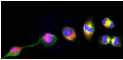 Dividing Neural Stem Cells