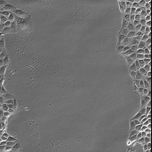 Leader cells drive migration and are then eliminated