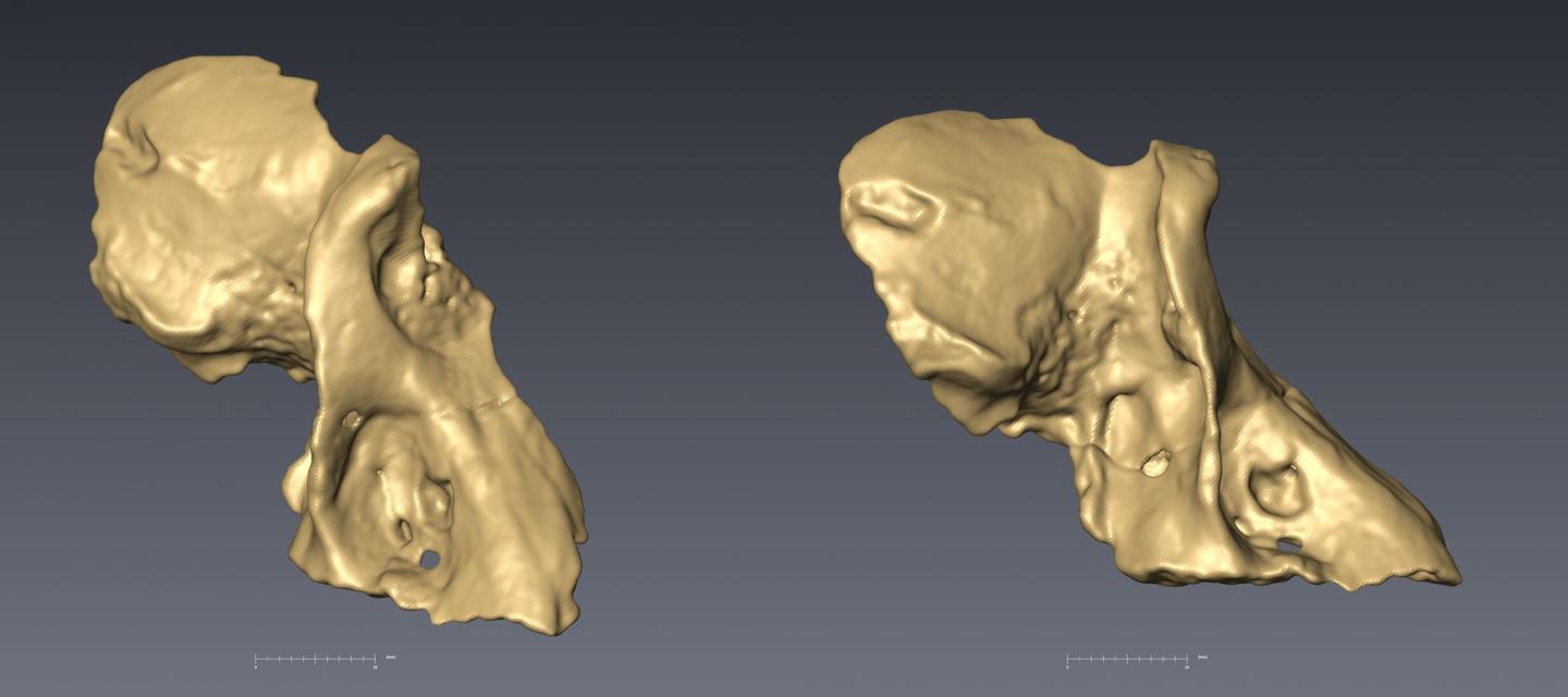CT Scans