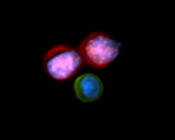 Circulating Tumor Cells