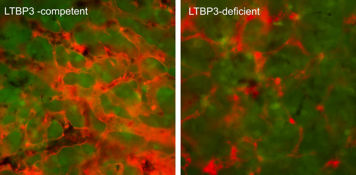 Tumor Blood Vessels