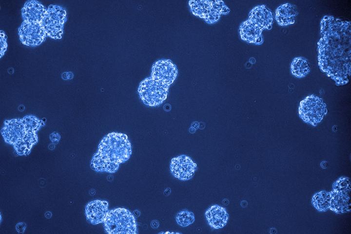 Brain Cancer Cells