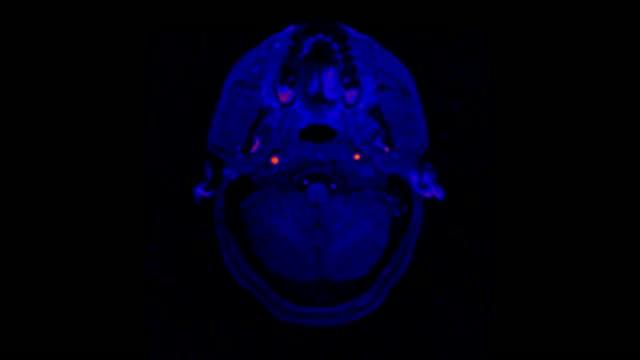 Study Finds Only a Small Portion of Synapses May Be Active