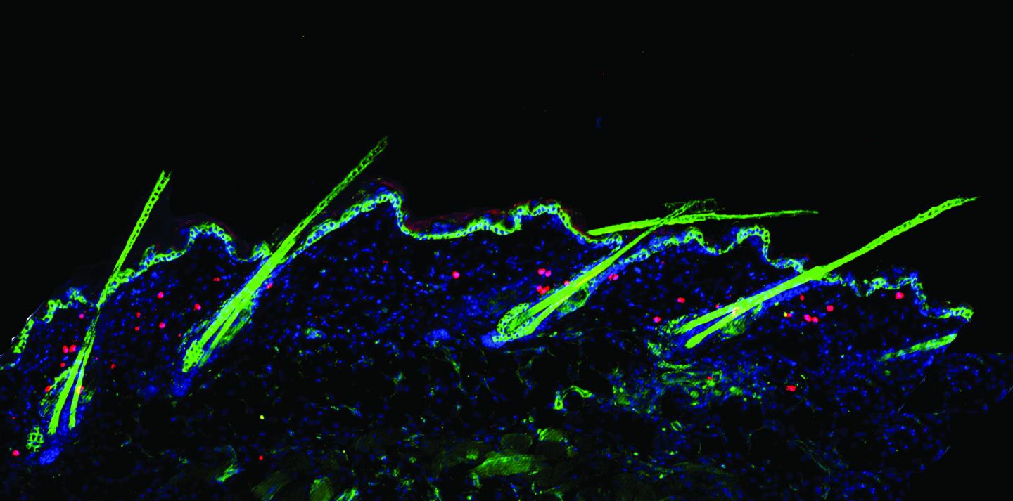 Tregs around Hair Follicles and Hairs