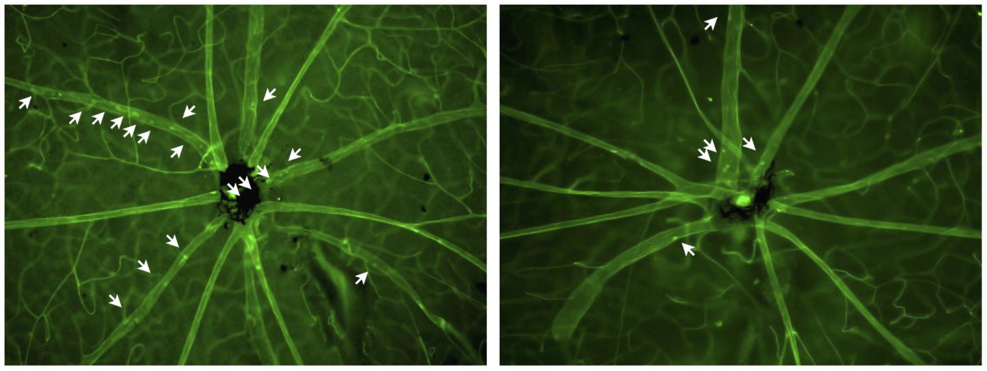 RNAi Agent 