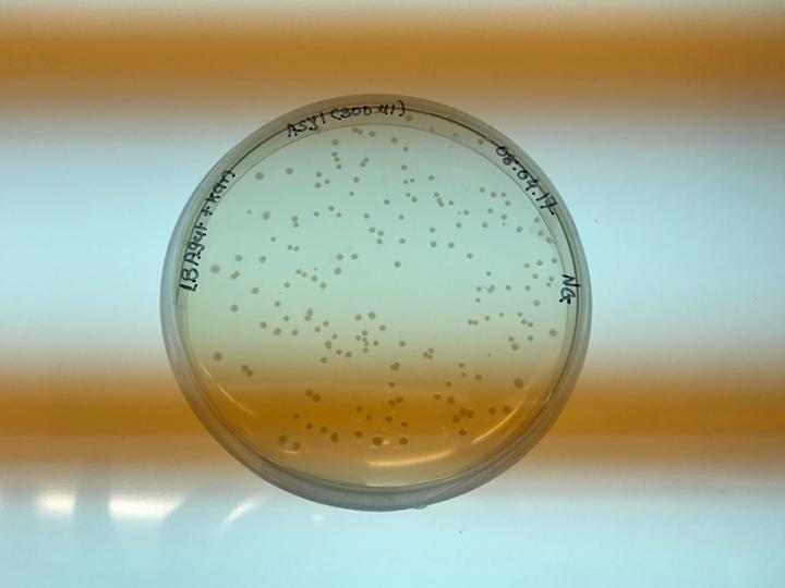 Recombinant bacteria
