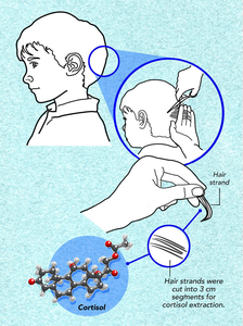 Cortisol Test