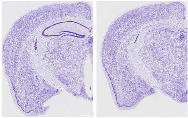 Tauopathy-Induced Neuronal Degeneration