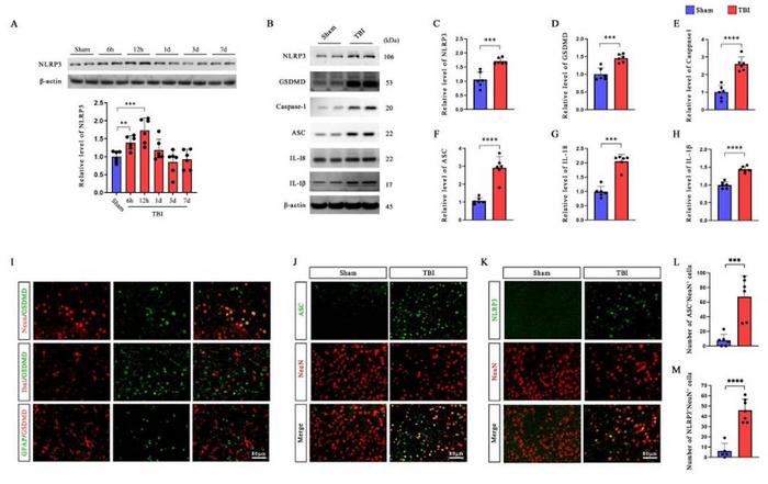 TBI induces NLRP3 inflammasome activation and neuronal pyroptosis.