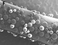 Synthetic Nerve Conduit Bridges the Gap in Arm Nerve Repair (3 of 10)