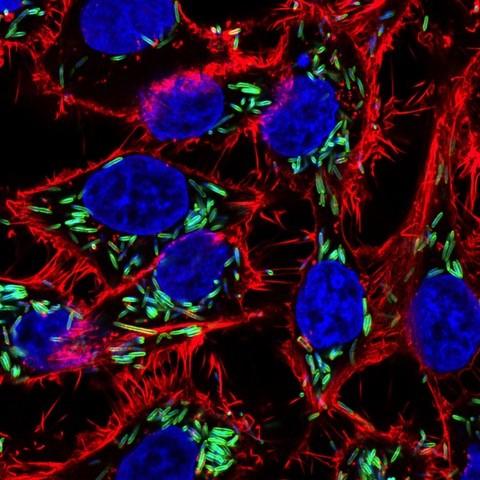 Bacterial Hitch-Hikers Within Tumors Accelerate the Spread of Colon Cancer Cells (1 of 1)