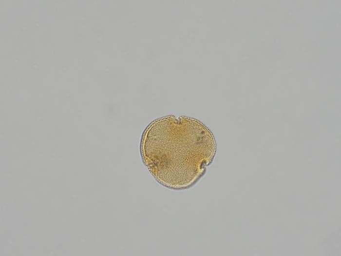 Fig. 2: Light microscope image of pollen extracted from the fossilised flower Tilia magnasepala (Fig. 1).