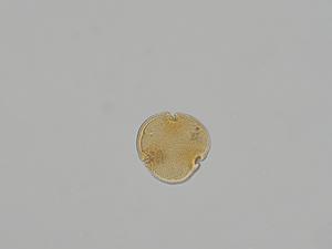 Fig. 2: Light microscope image of pollen extracted from the fossilised flower Tilia magnasepala (Fig. 1).