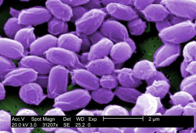 Anthrax Prevention